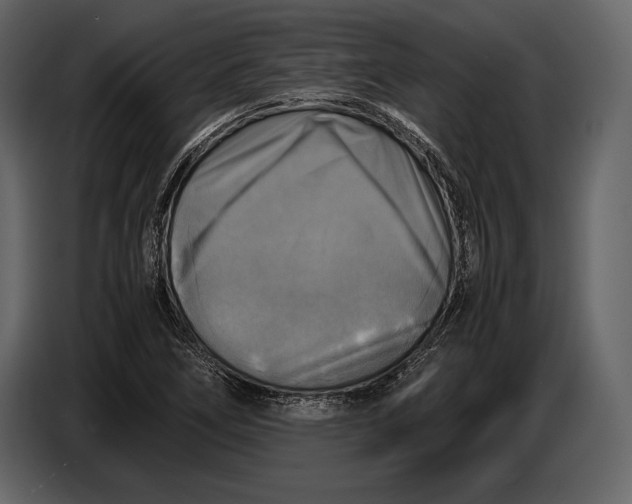 X0000087011266200705071519