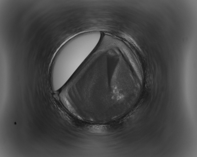 X0000087011268200705071519