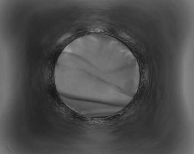 X0000087011446200705071516