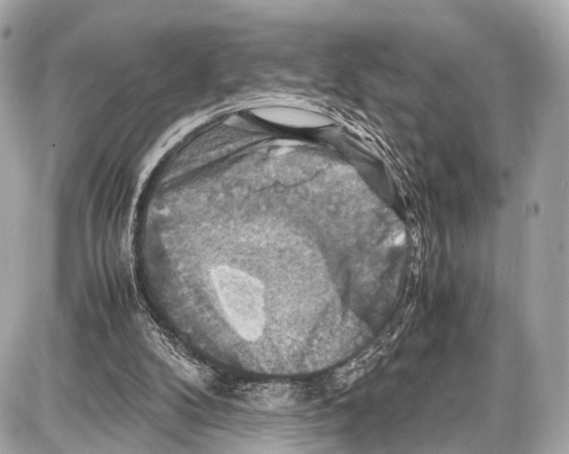 X0000087010104200705141841