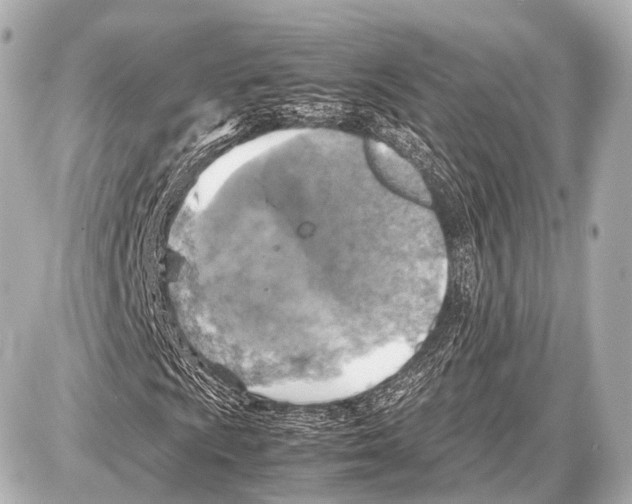 X0000087011009200705141826