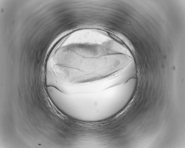 X0000087011052200705141826