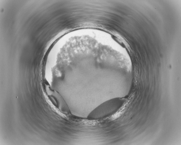 X0000087011142200705141825