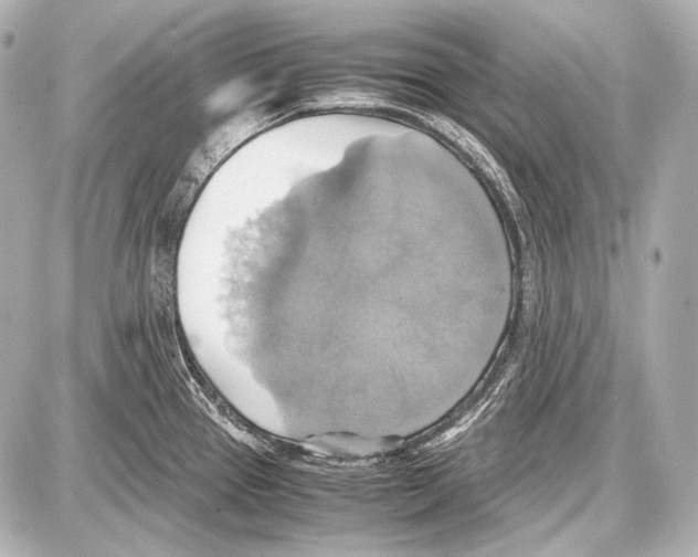 X0000087011337200705141822