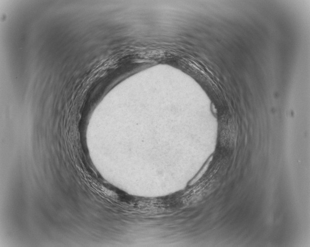 X0000087011345200705141821