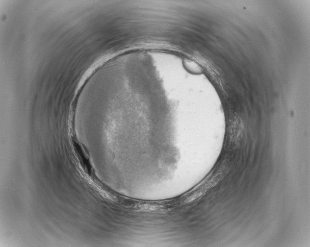 X0000087011374200705141820