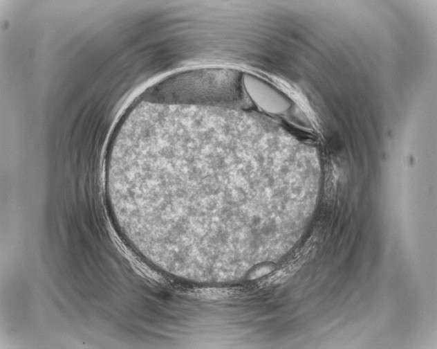 X0000087011380200705141820