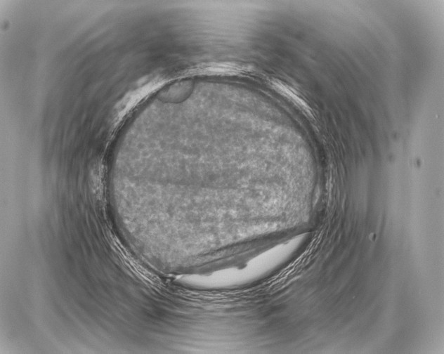 X0000087011404200705141820