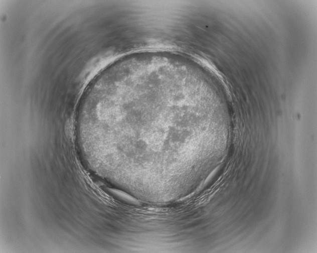 X0000087011412200705141820