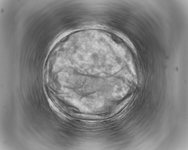 X0000087011439200705141820