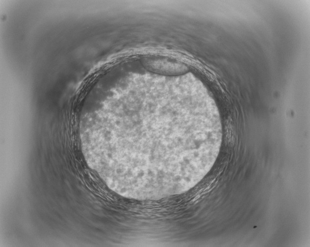 X0000087011494200705141818