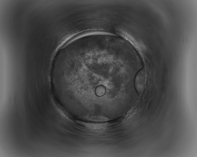 X0000087020155200704161607