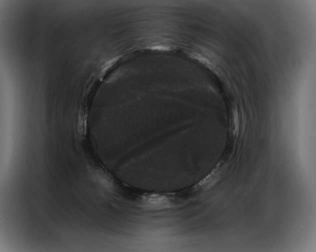X0000087020180200704161607