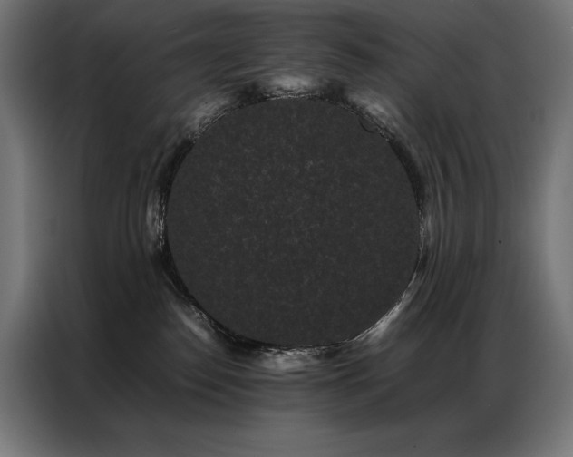 X0000087020186200704161607