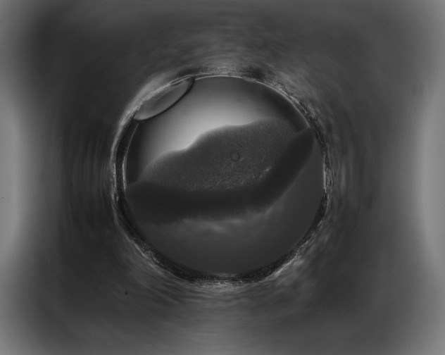 X0000087020198200704161607