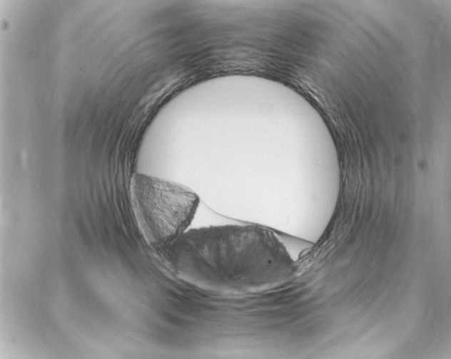 X0000087020093200705071520