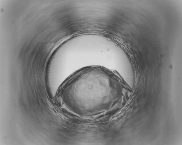 X0000087020146200705071518