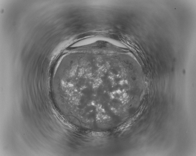 X0000087020149200705071518