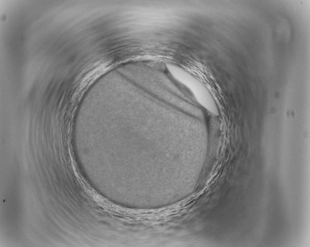 X0000087020001200705141908