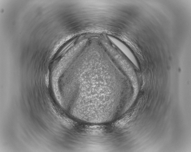 X0000087020064200705141907