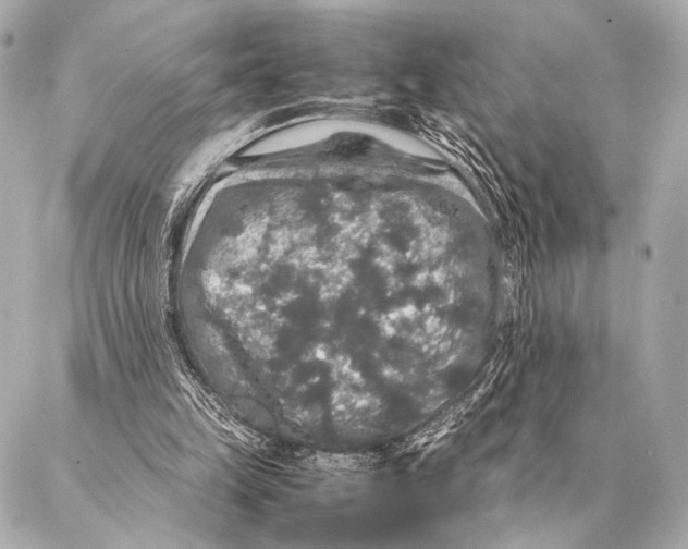 X0000087020149200705141905