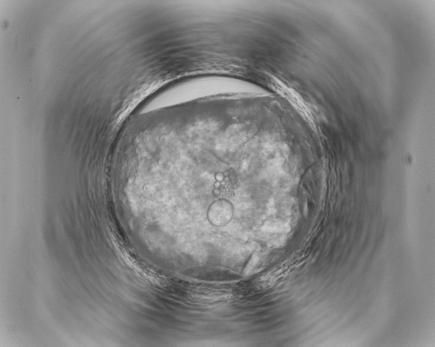 X0000087020155200705141905