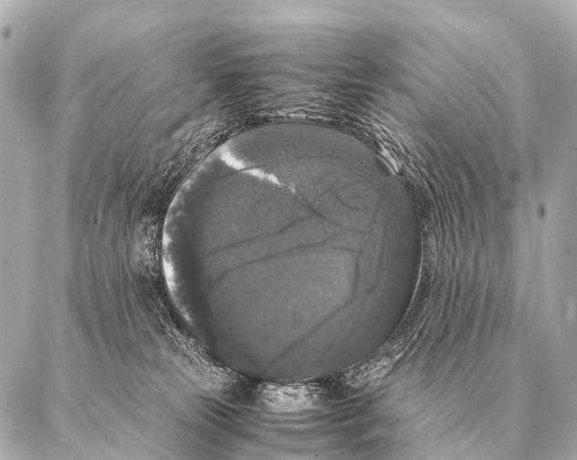 X0000087020181200705141905