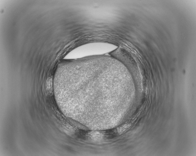 X0000087020425200705141901