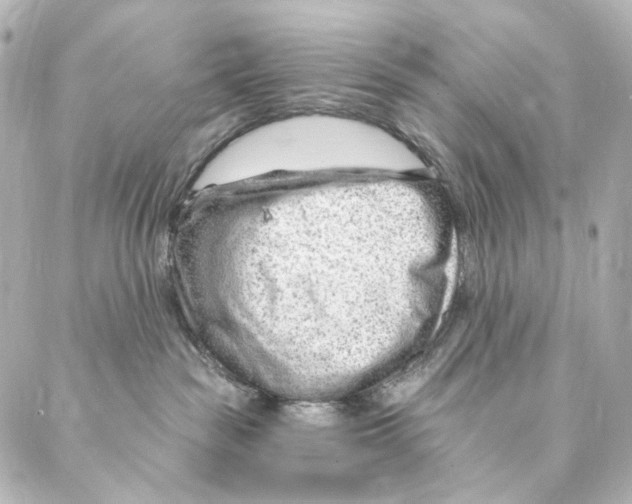 X0000087030189200705141931