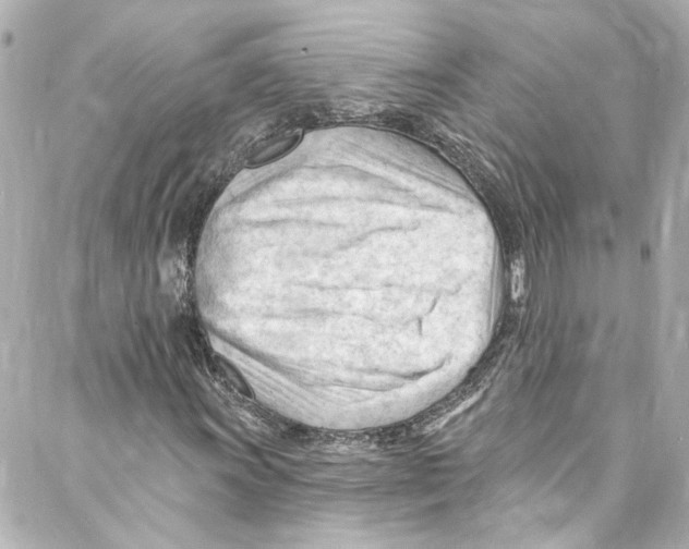 X0000087031011200705141916