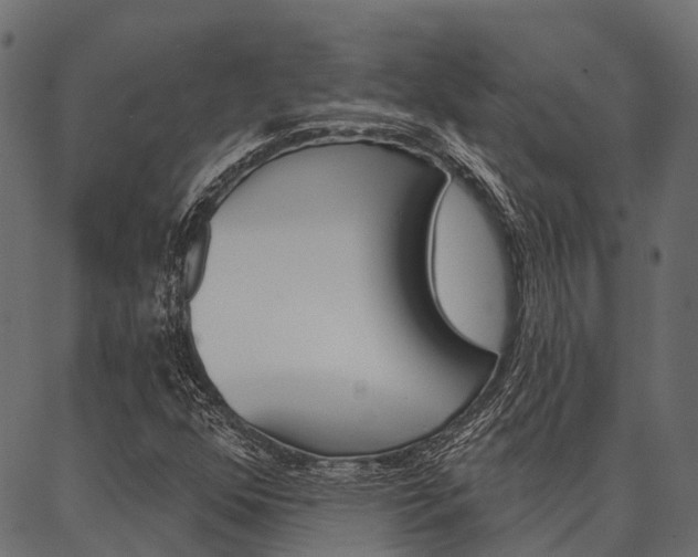 X0000087041352200704180927