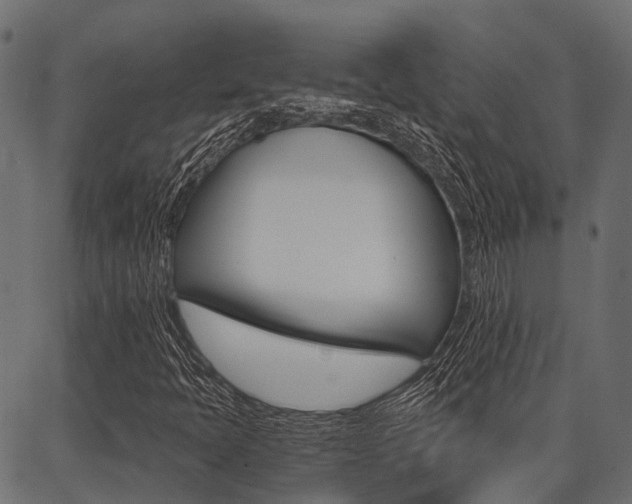 X0000087041397200704180925