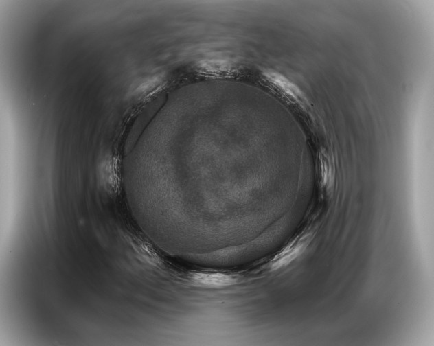 X0000087041156200704181209