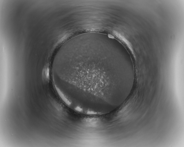 X0000087040067200705021145
