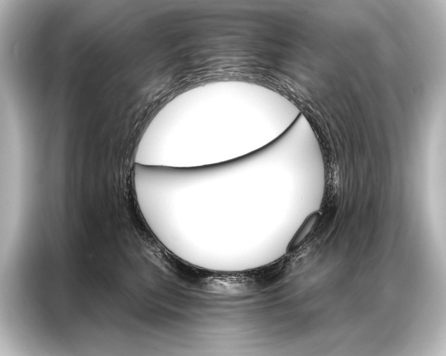 X0000087040567200705021139