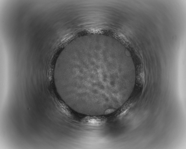 X0000087040658200705021137