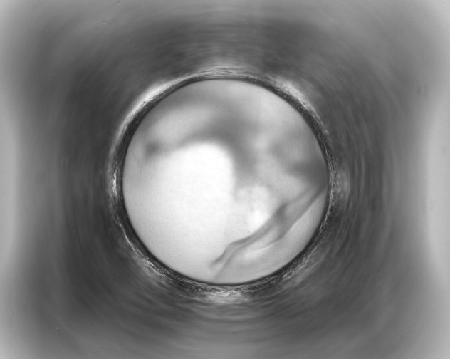X0000087041462200705021127