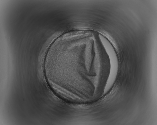 X0000087040385200705160935