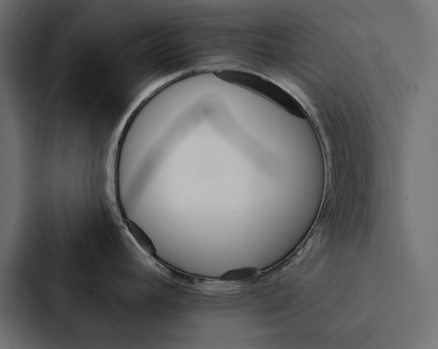 X0000087041392200705160919