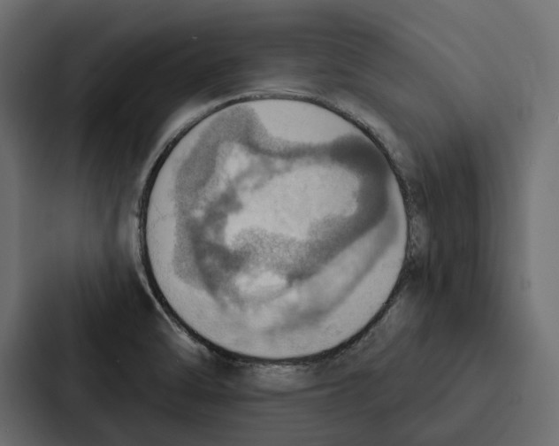 X0000087041470200705160918