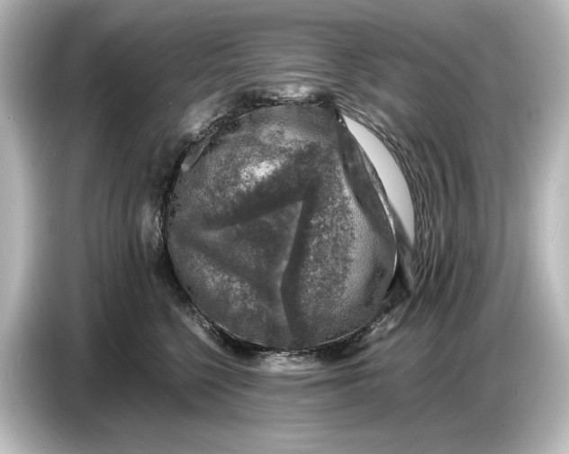 X0000087050568200705021159