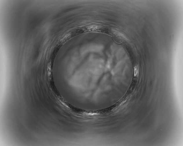 X0000087051011200705021152