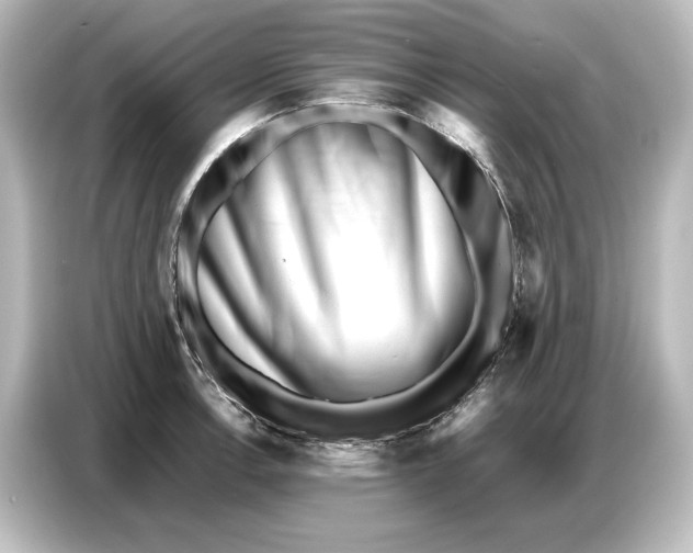 X0000087051138200705021151