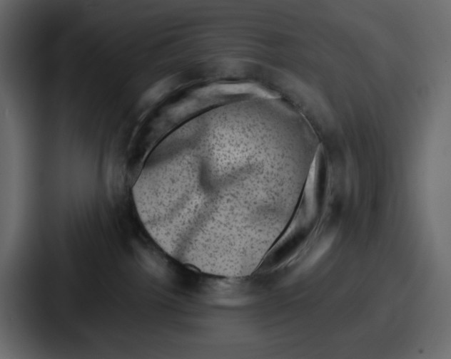 X0000087050092200705161000