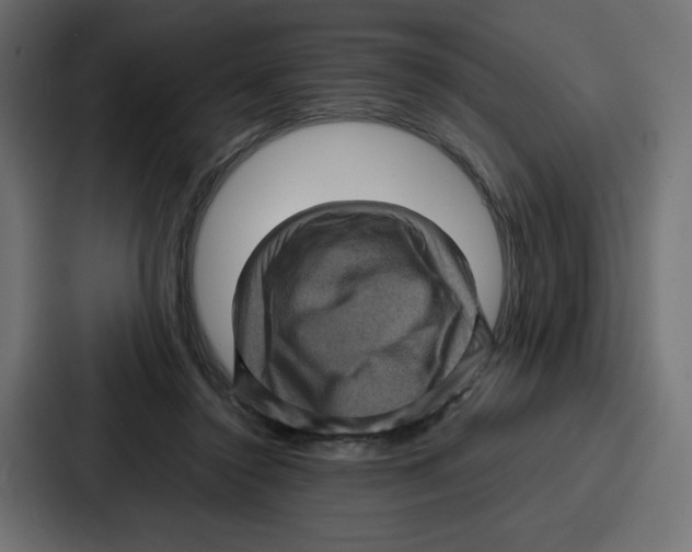 X0000087050356200705160956