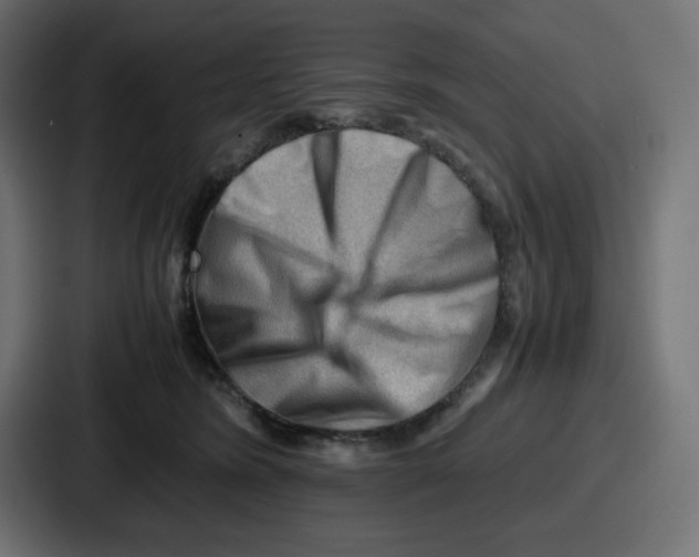 X0000087050420200705160955