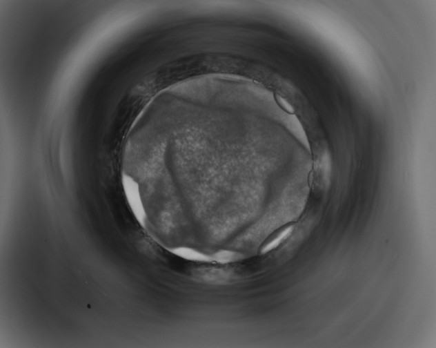 X0000087050765200705160951