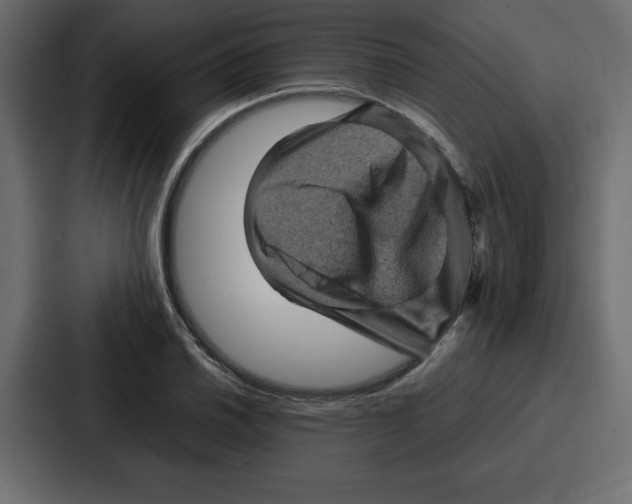 X0000087051030200705160947