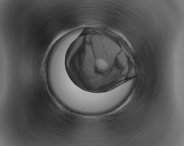 X0000087051114200705160945