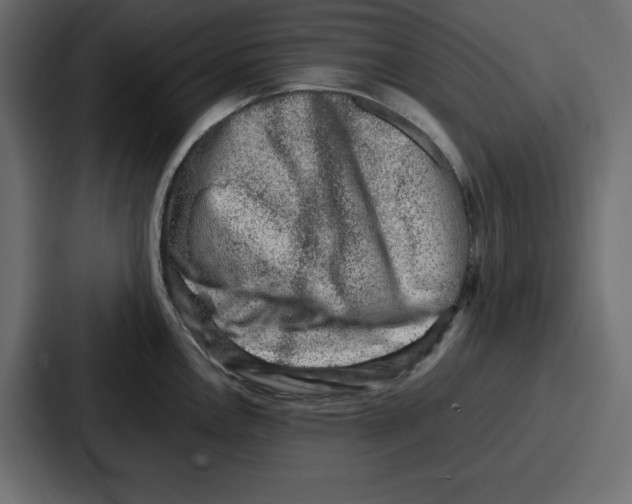 X0000087051146200705160946